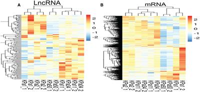 Integrated analysis of long non-coding RNAs and mRNAs associated with glaucoma in vitro